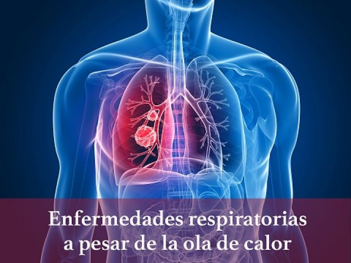 Imágen de noticia Imagen de noticia